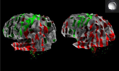 Créé le premier atlas du cerveau humain au monde