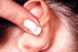Inflammation Des Ganglions Lymphatiques Derriere L Oreille Symptomes Diagnostic Traitement Inflammation Des Ganglions Lymphatiques Derriere L Oreille Symptomes Diagnostic Traitement