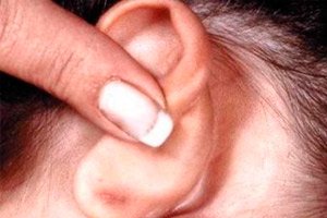 Inflammation Des Ganglions Lymphatiques Derriere L Oreille Symptomes Diagnostic Traitement