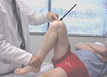 La douleur dans le genou pendant la flexion est la raison la plus commune pour laquelle les gens visitent les médecins traitants. 