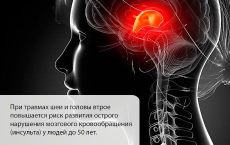 La probabilité d'un AVC augmente dans les premiers mois après une blessure à la tête ou au cou